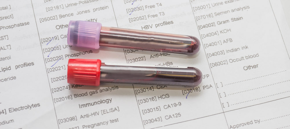 Coumadin and Clotting Factors