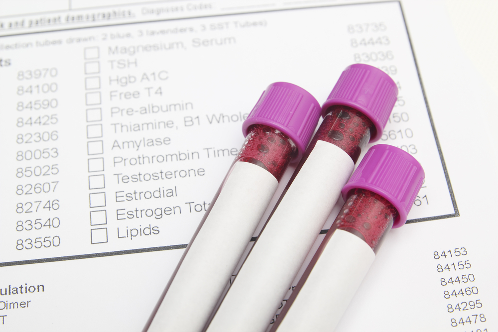 Discontinuing Labwork With Medications