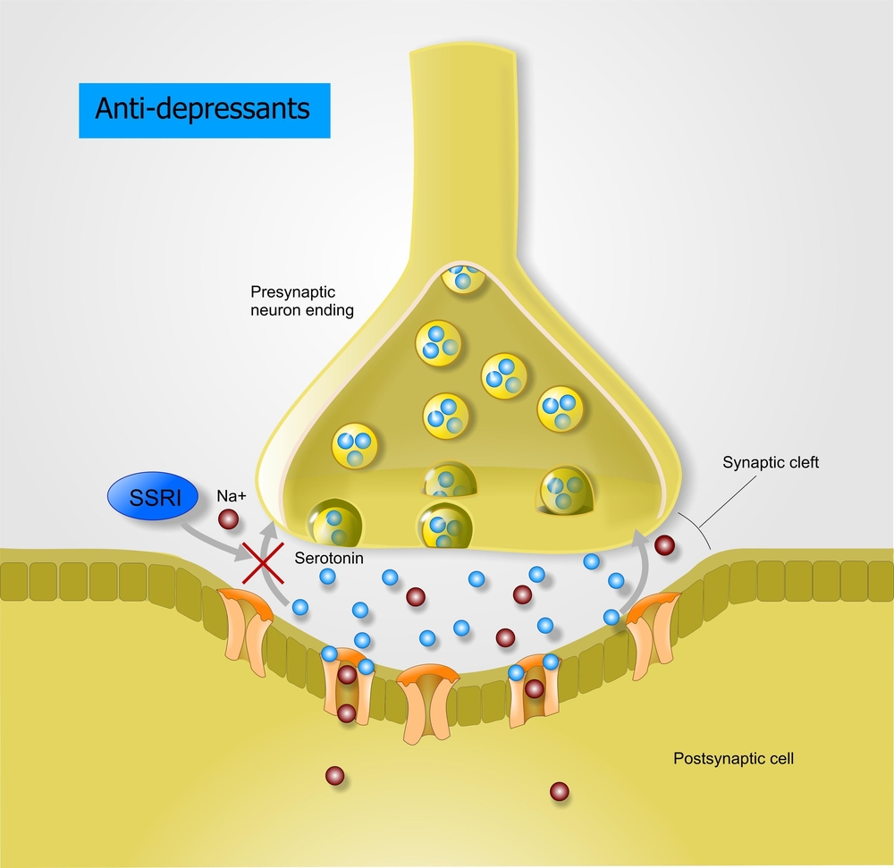 Serotonin Syndrome or Something Else?