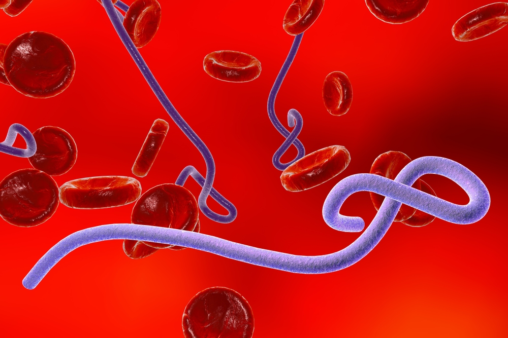 Ebola in the US – Is a Nurse the Villian?