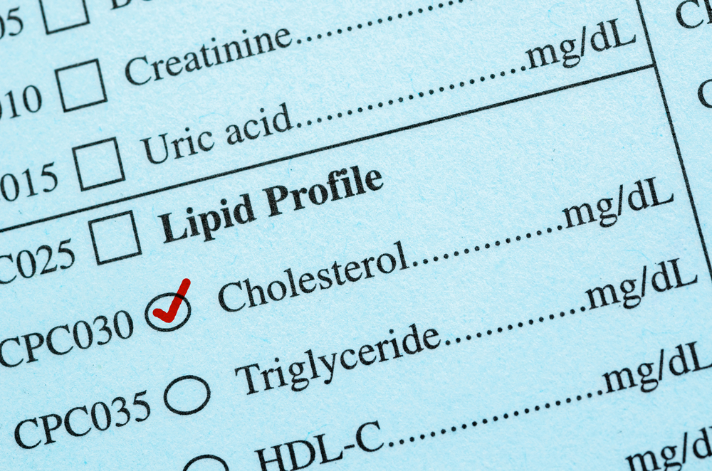 Patient Misconceptions – Statin and Grapefruit Juice Interaction