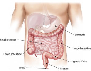 GI risk with NSAIDs