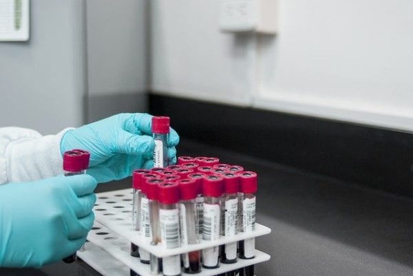 Appropriate Lab Monitoring in HIV