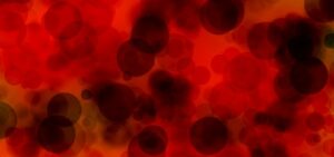 PPI use in lower GI bleeds