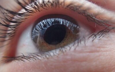 Tamsulosin And Cataract Surgery – Case Study