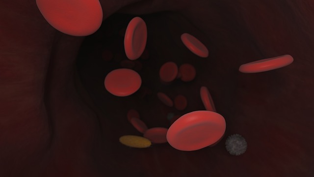 Comparing Clopidogrel Versus Prasugrel