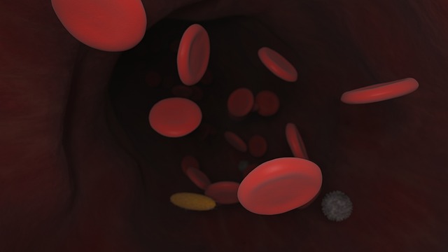 Comparing Clopidogrel Versus Prasugrel