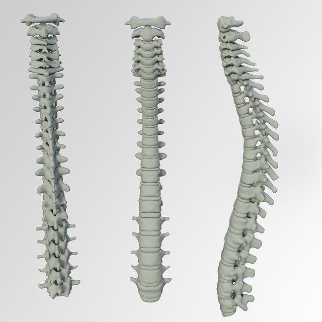 Denosumab Discontinuation and Increased Vertebral Fractures