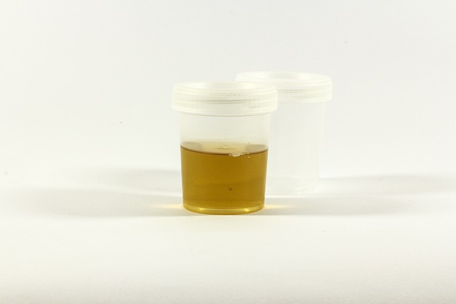 Top 3 Drugs That Change Urine Color