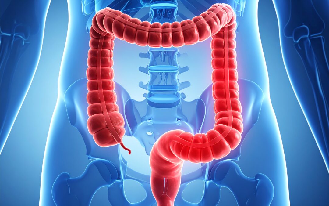 Case Study – Renal Dose Adjustment and Constipation Polypharmacy