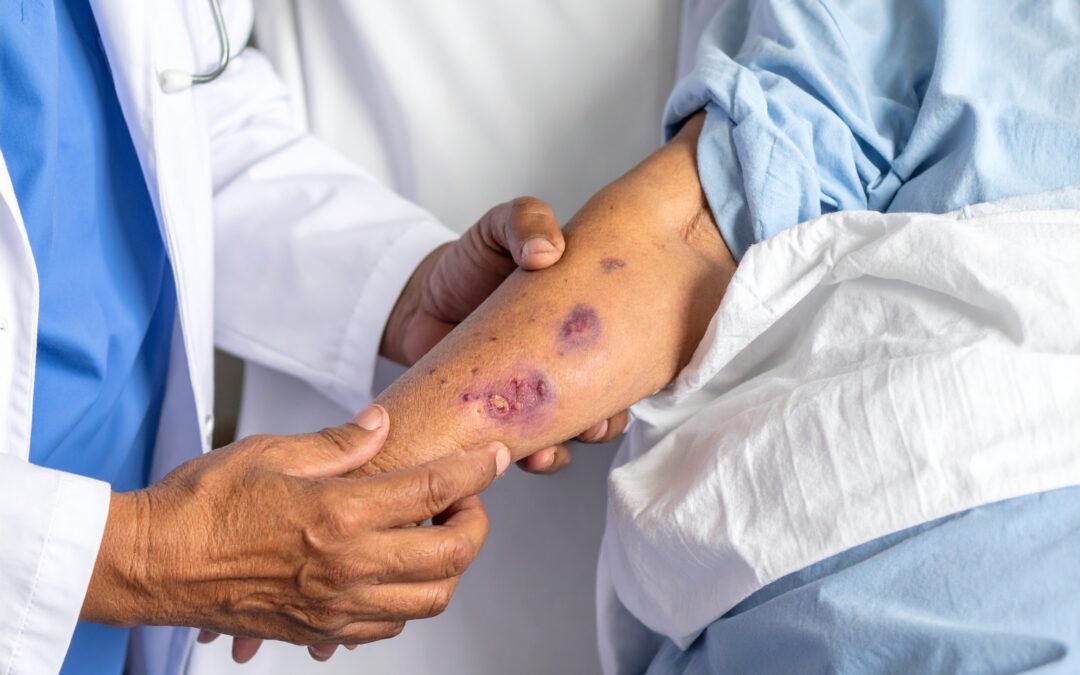 Can You Identify Two Important Drug Interactions? Case Study
