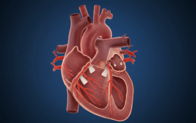 Free Atrial Fibrillation Quiz – NAPLEX, BCPS and Other Board Exam Prep