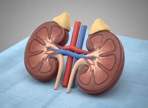 Rhabdomyolysis can lead to Acute Renal Failure